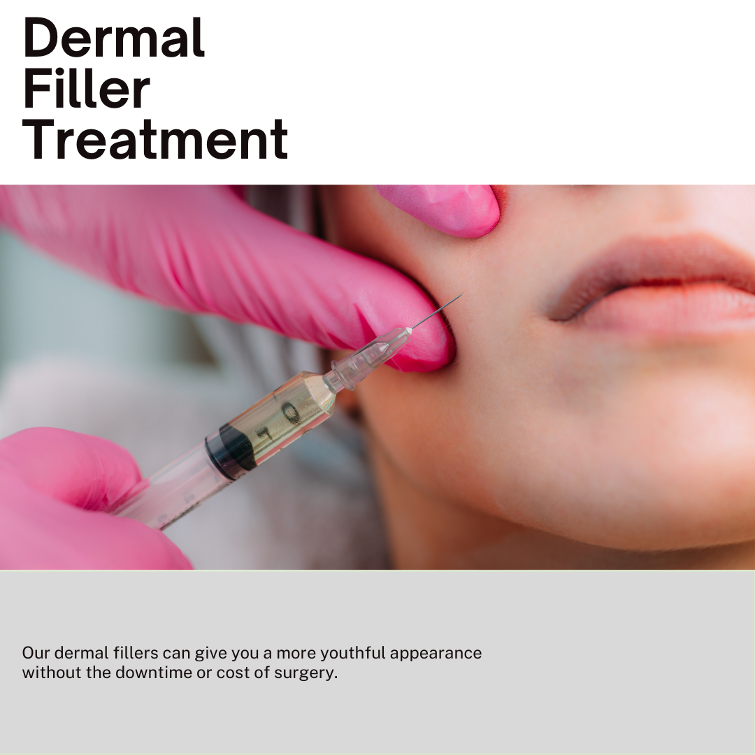 Ourdermalfillerscangiveyouamoreyouthfulappearancewithoutthedowntimeorcostofsurgery.copy